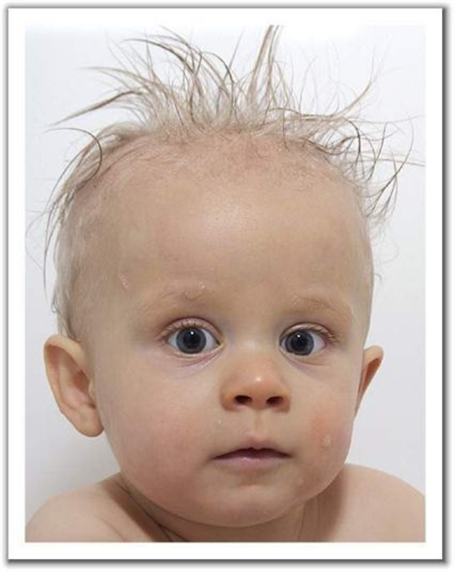 Bad Hair Muldoon                                                                                                                                                                                                                                               